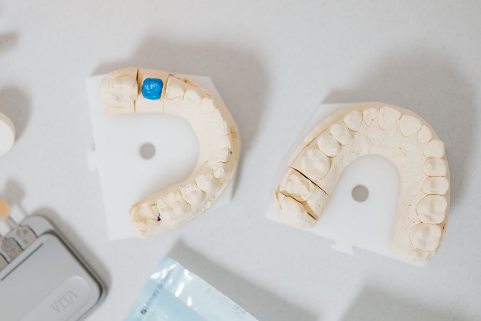 Coronas de Zirconio: Innovación en Odontología Forense