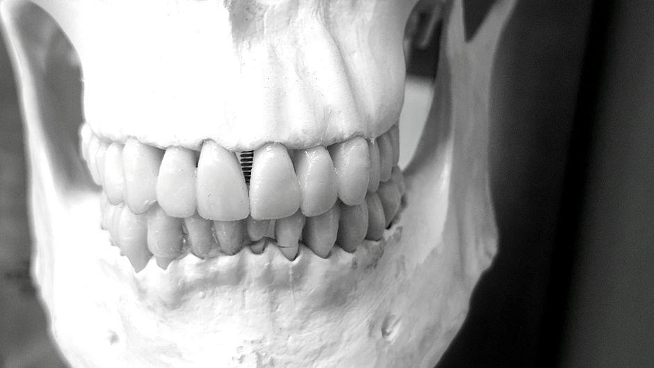 Odontología Forense: Resolviendo Misterios Dentales